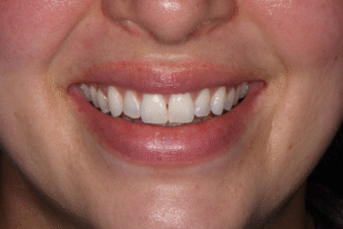 patient 10 before