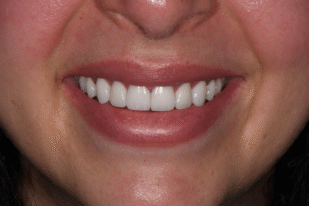 patient 10 after