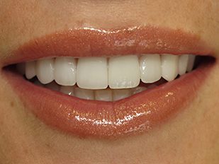 patient 28 after
