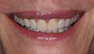 patient 12 before