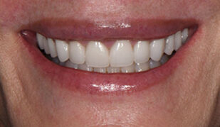 patient 12 after