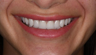 patient 11 after