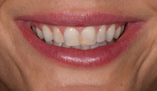 patient 10 before