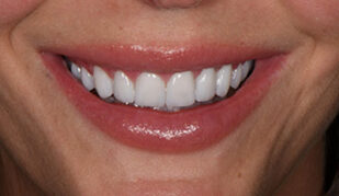 patient 10 after