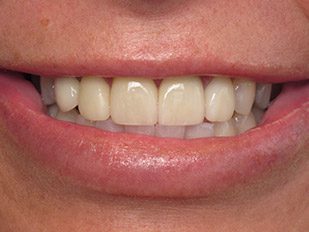patient 57 before