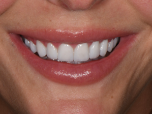 patient 12 after