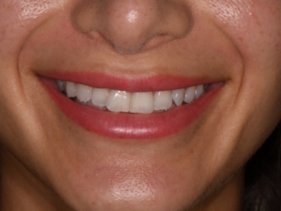 patient 13 before