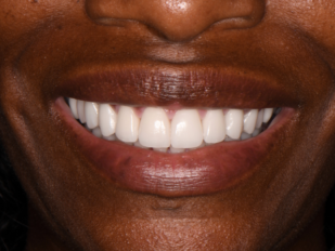 patient 15 after